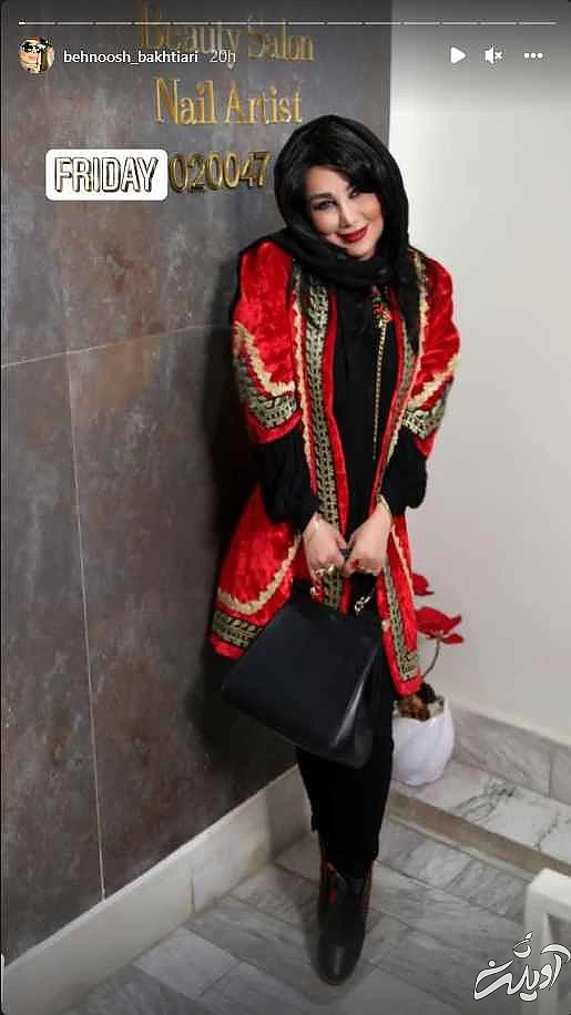 این خانم بازیگر رکورددار جراحی زیبایی ایرانی ! + تصاویری افشاگر !